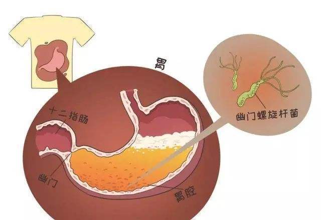 2025新澳门开奖记录和恋爱后莫名口臭胃痛与谈恋爱口臭